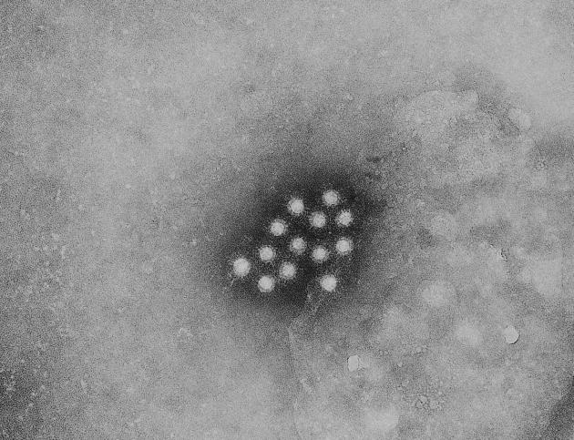 Hepatitis_A_virus_01