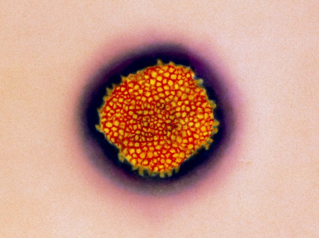 Lassa fever virus particle